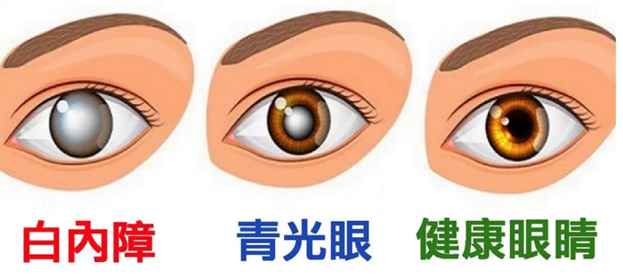 ae78fa5c2f804929b10b93ad568a5093.jpg